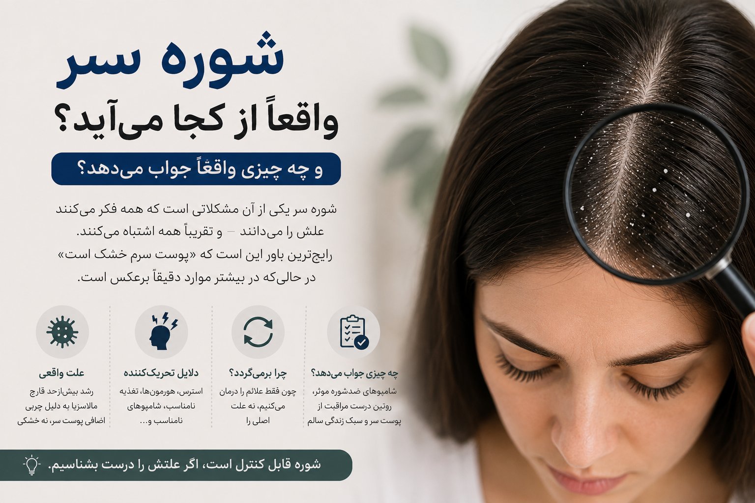 شوره سر: علت واقعی چیست و چطور برای همیشه کنترلش کنیم؟